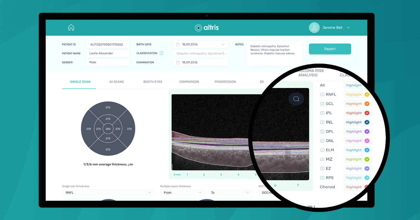 OCT Imaging System