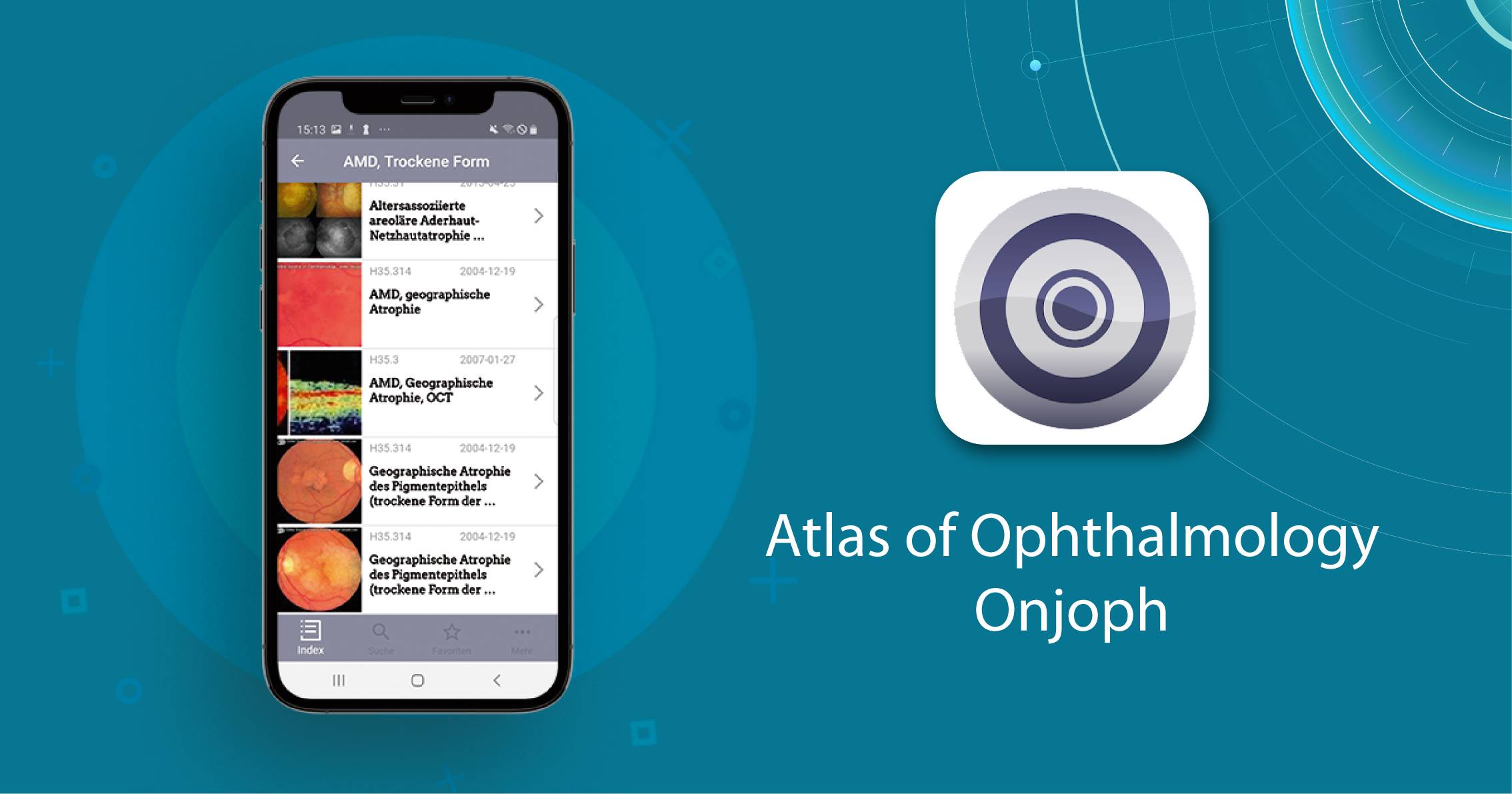 mobile ophthalmology app
