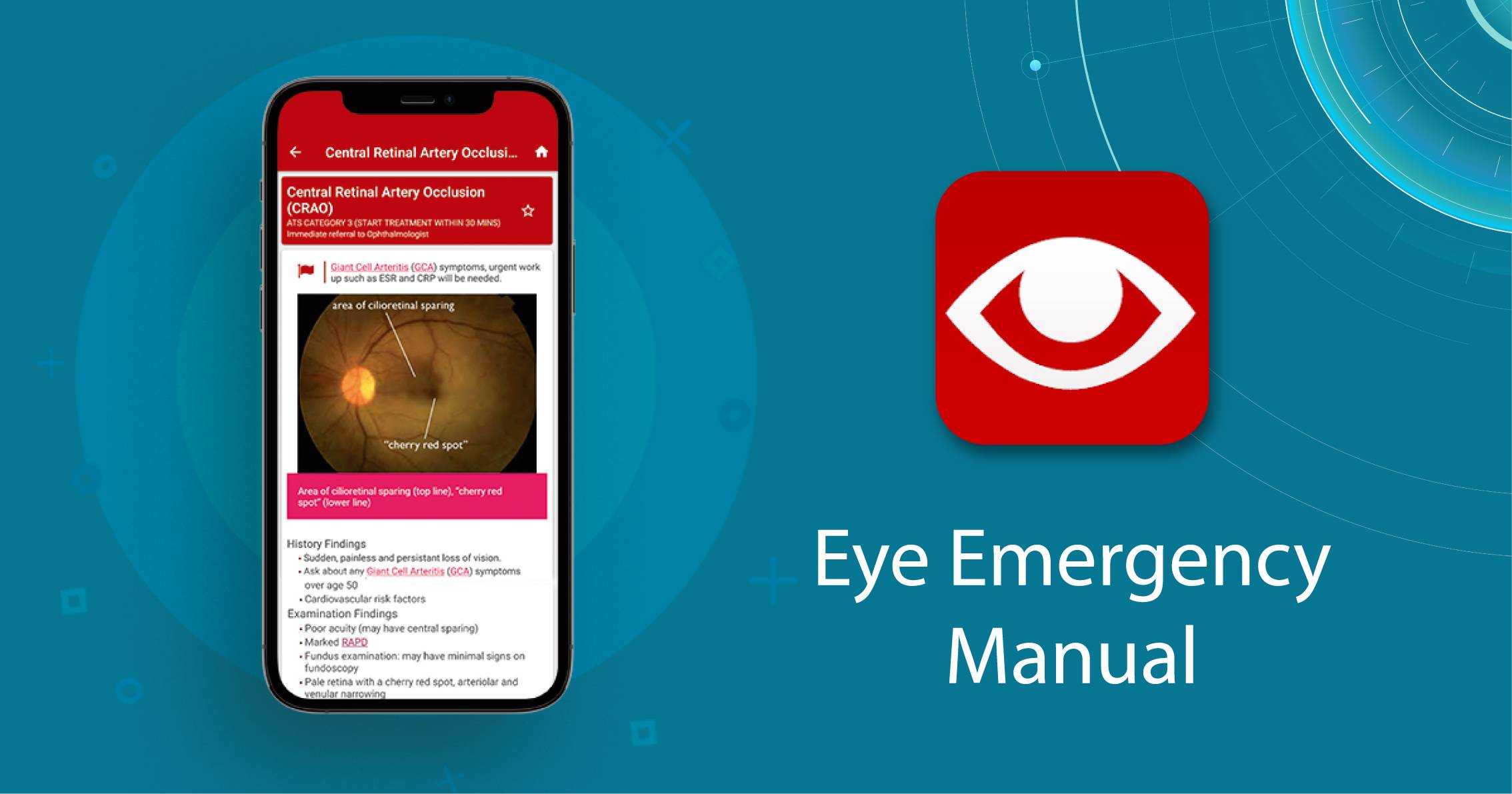 mobile ophthalmology app