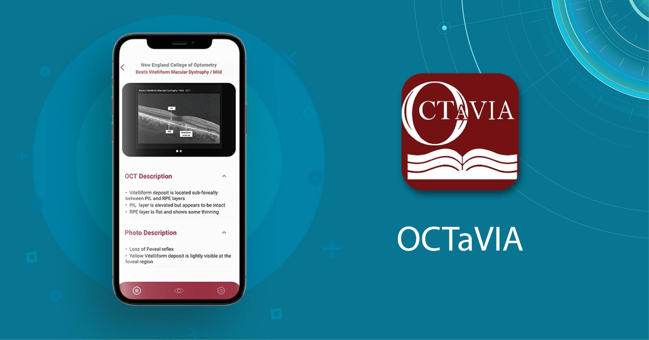 mobile ophthalmology app