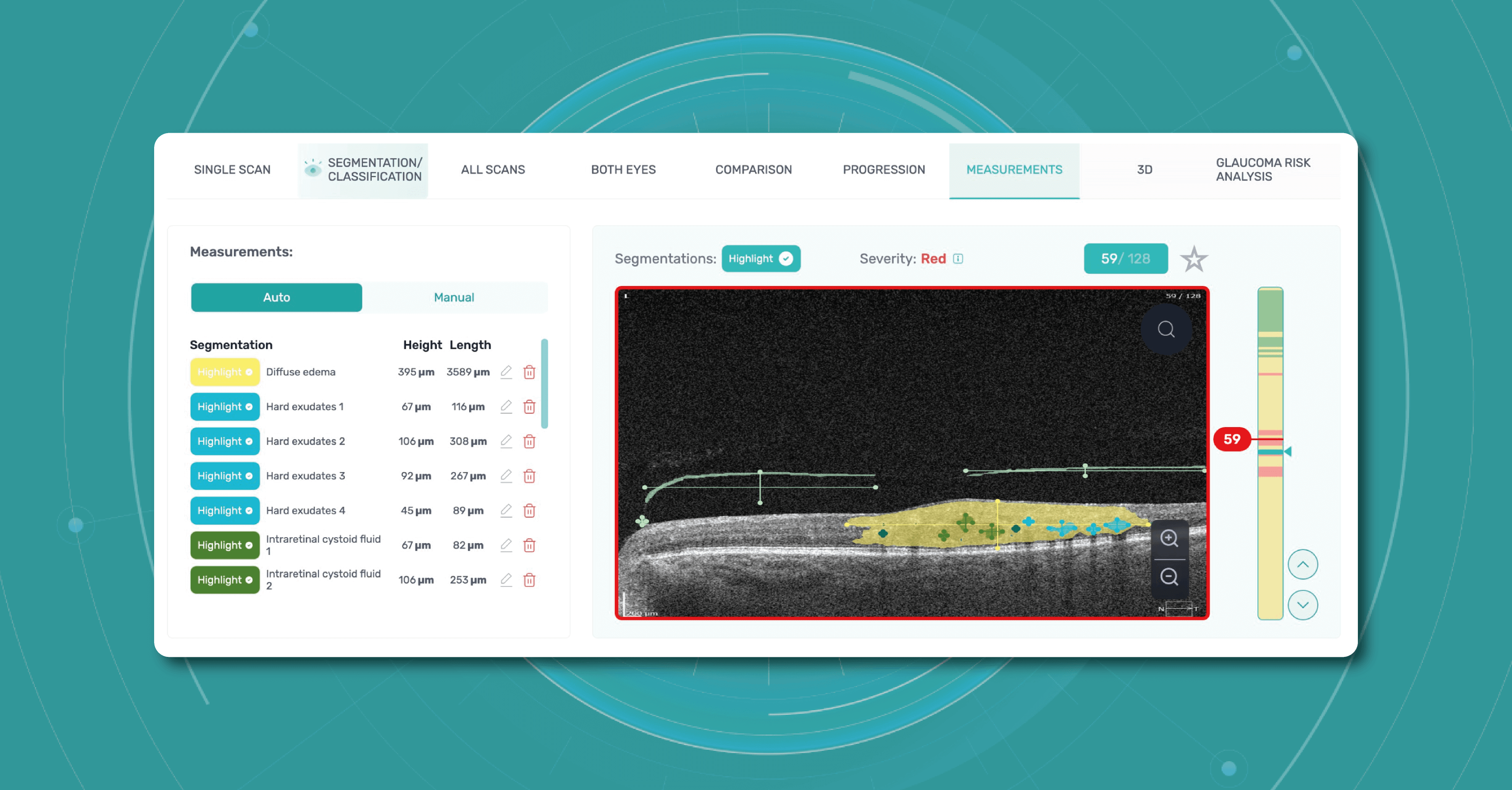 DICOM file format