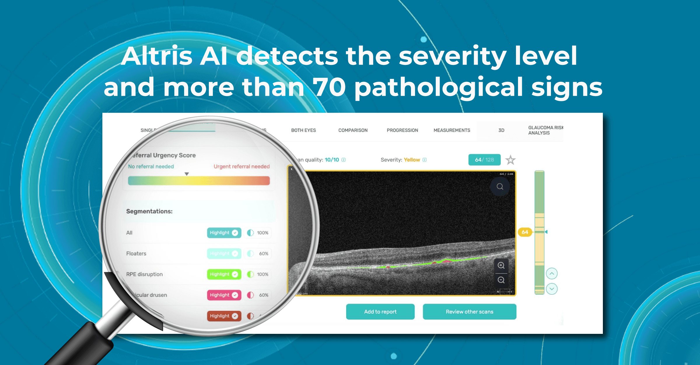 OCT eye test