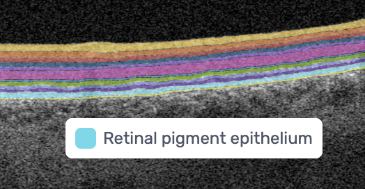 AI Ophthalmology and Optometry | Altris AI