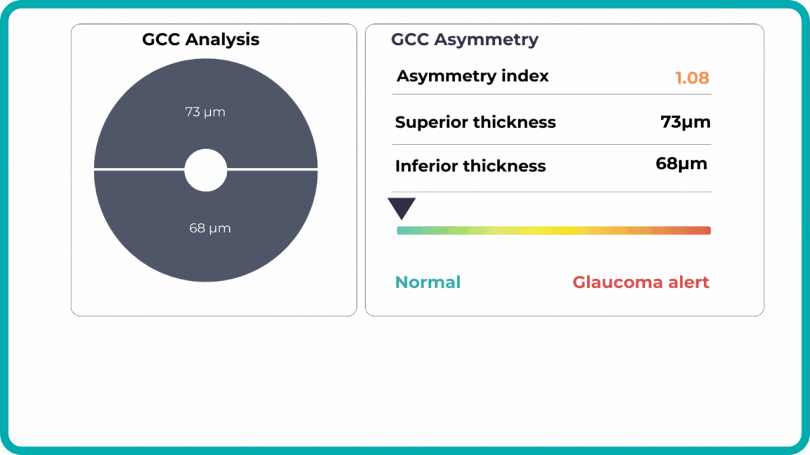 technology in optometry