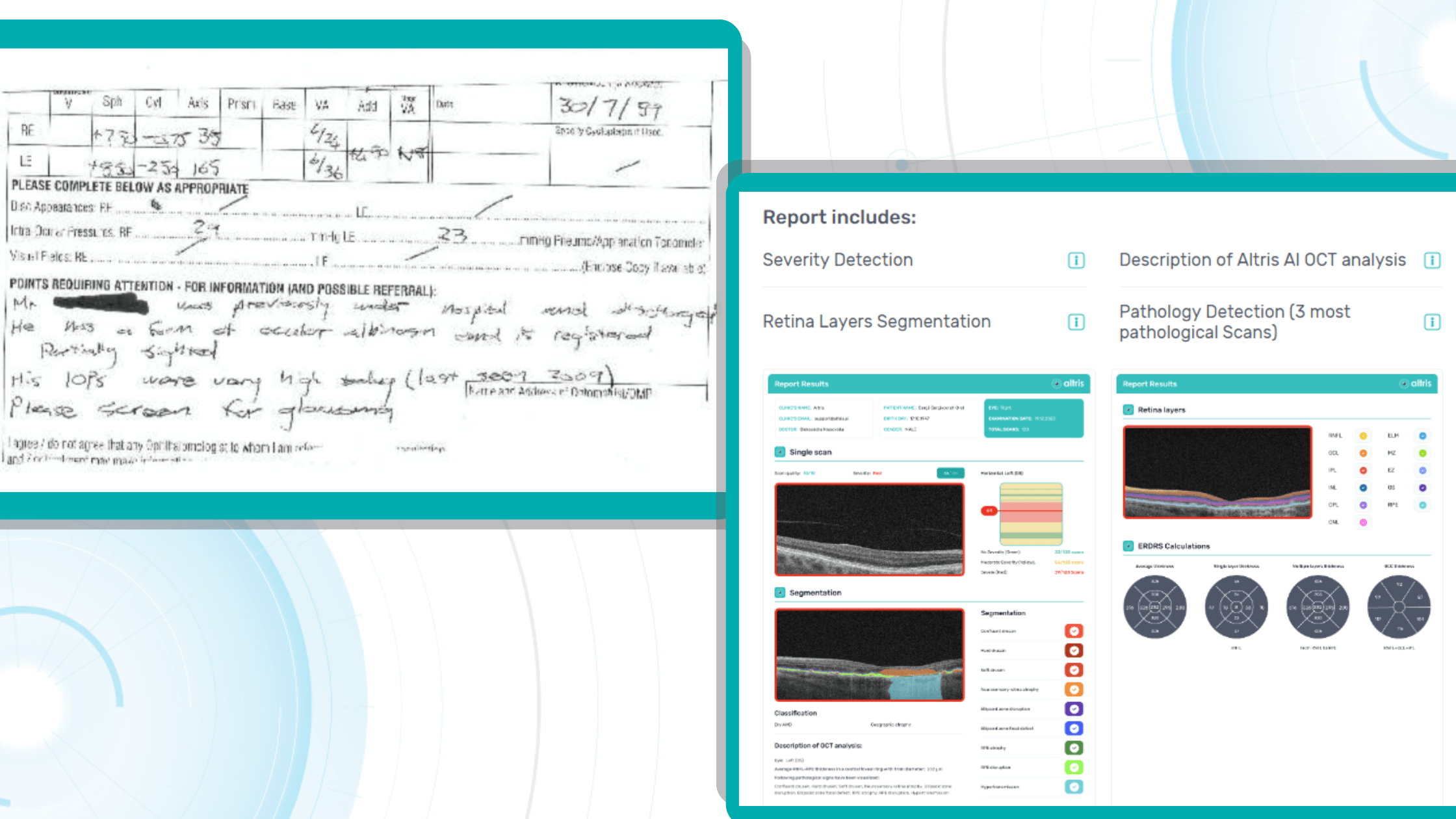 Increasing Referral Efficiency in Eye Care: customizable OCT reports vs written reports