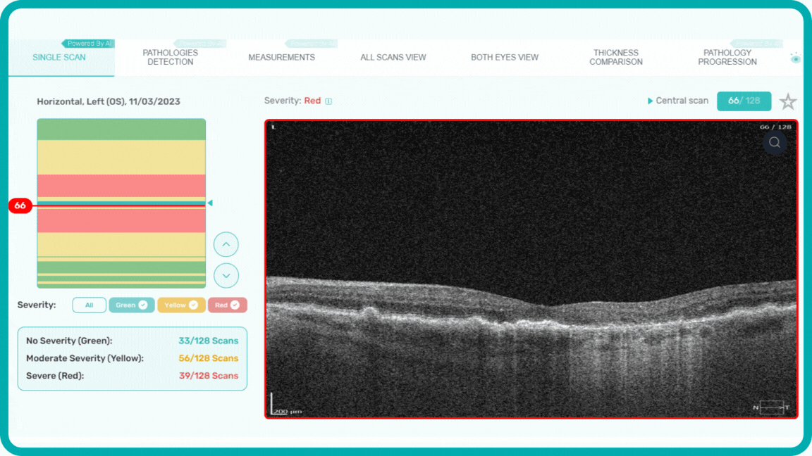 OCT Optometry