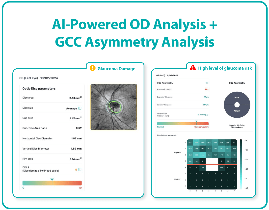 AI Ophthalmology and Optometry | Altris AI