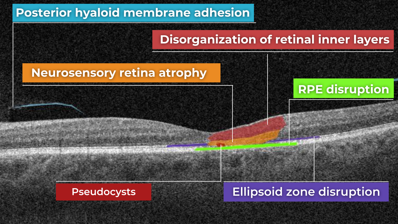 future of ophthalmology