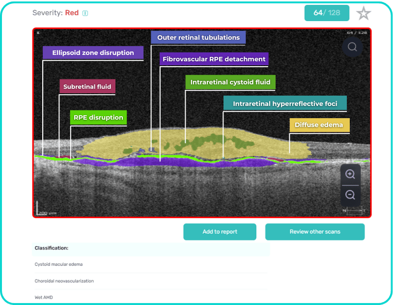 AI Ophthalmology and Optometry | Altris AI