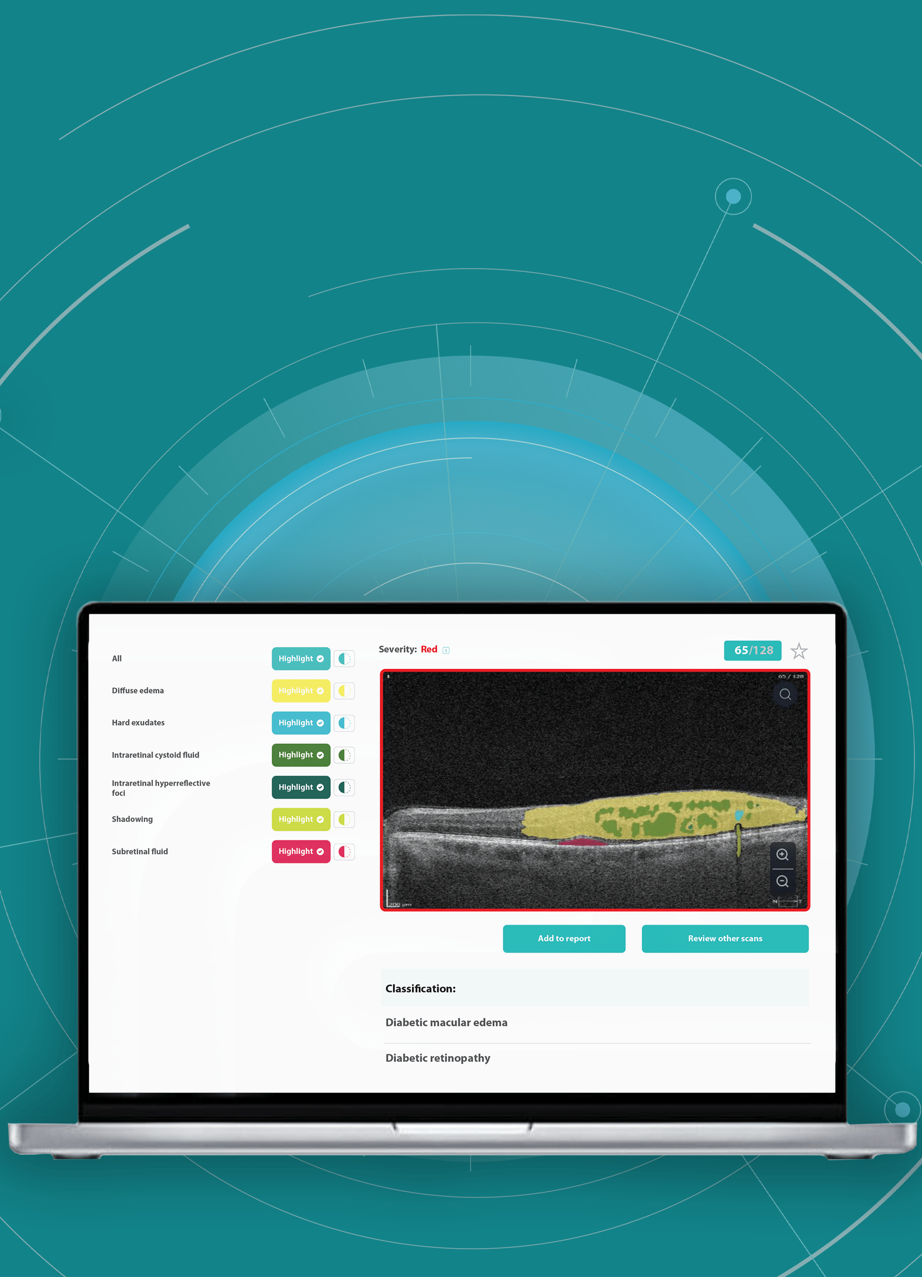 AI Ophthalmology and Optometry | Altris AI