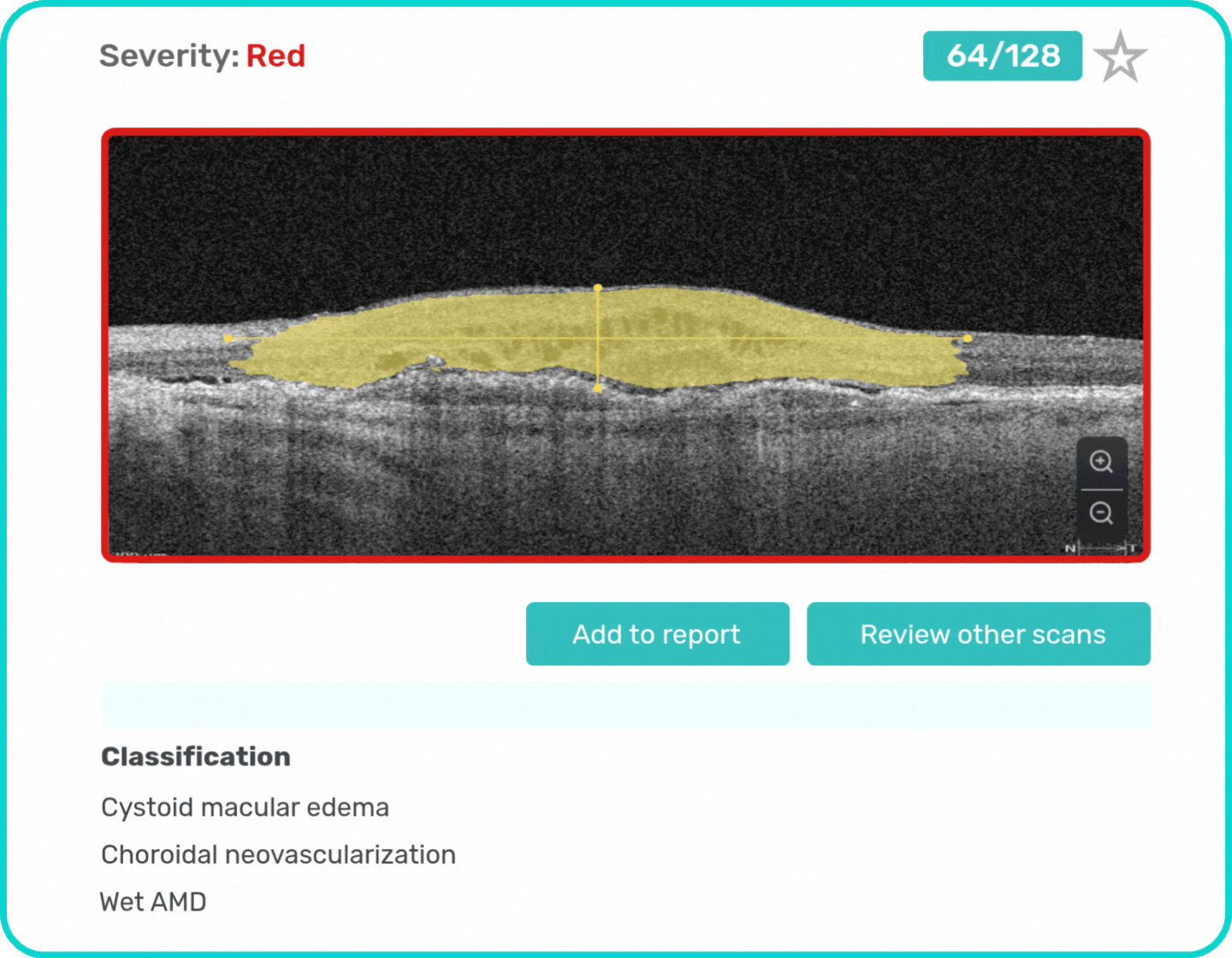 AI Ophthalmology and Optometry | Altris AI