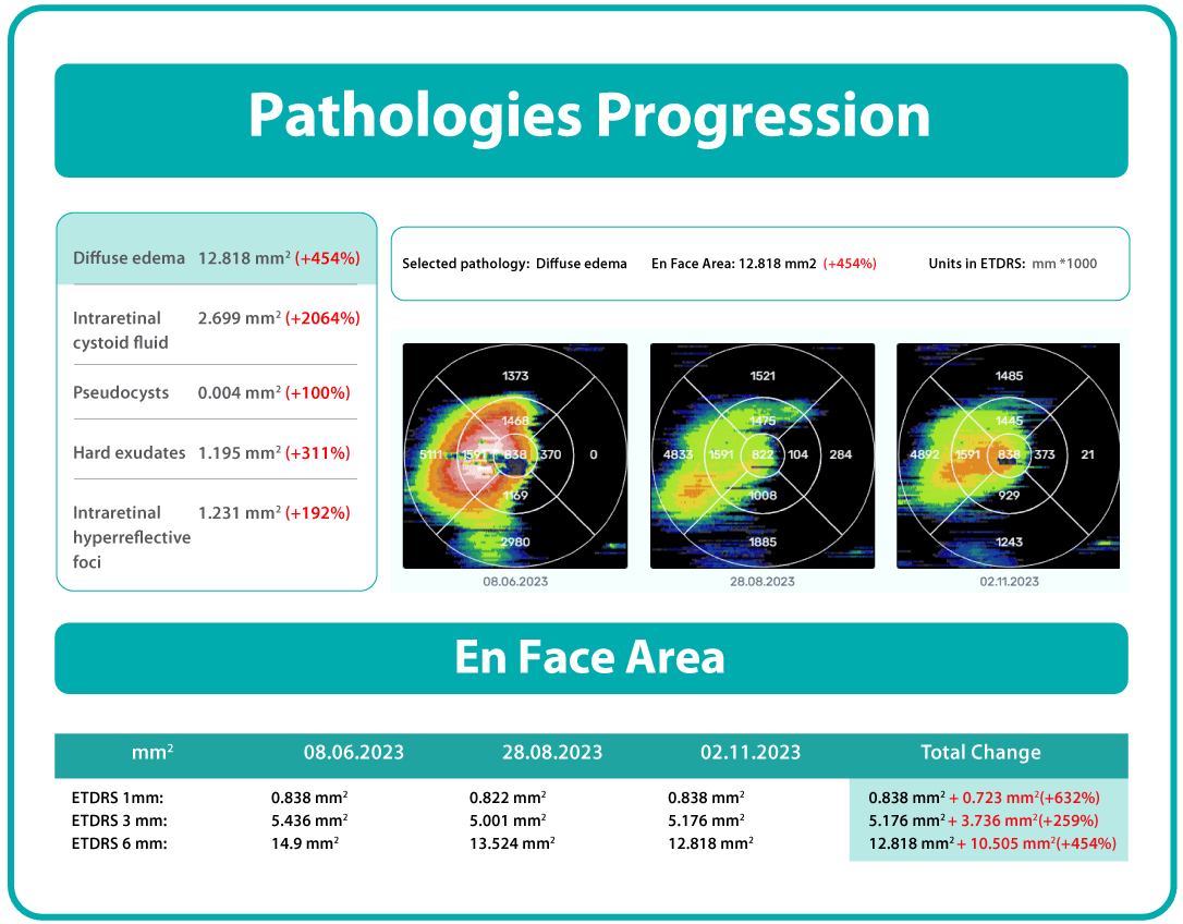 AI Ophthalmology and Optometry | Altris AI