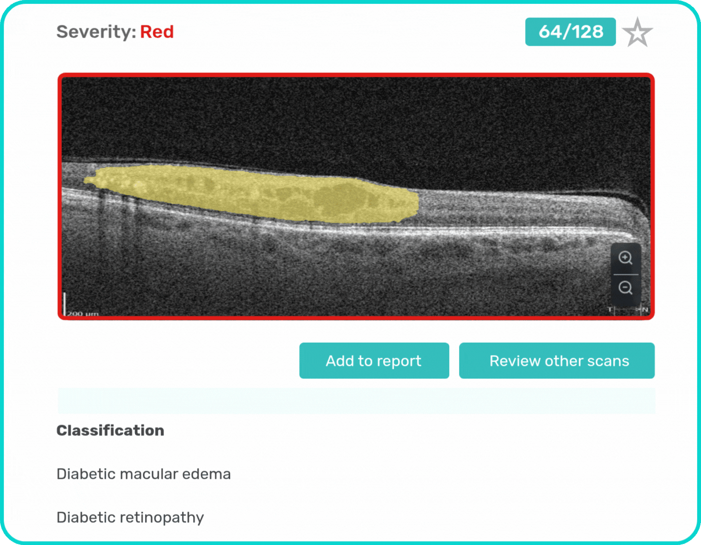 AI Ophthalmology and Optometry | Altris AI