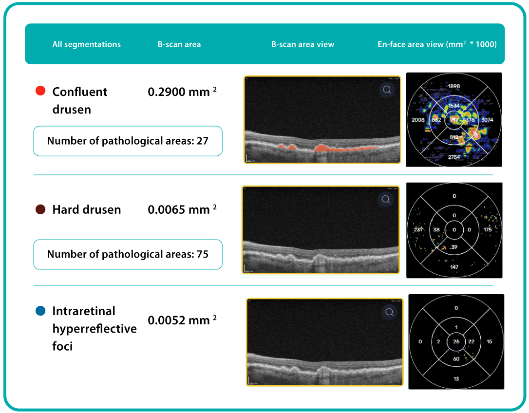AI Ophthalmology and Optometry | Altris AI