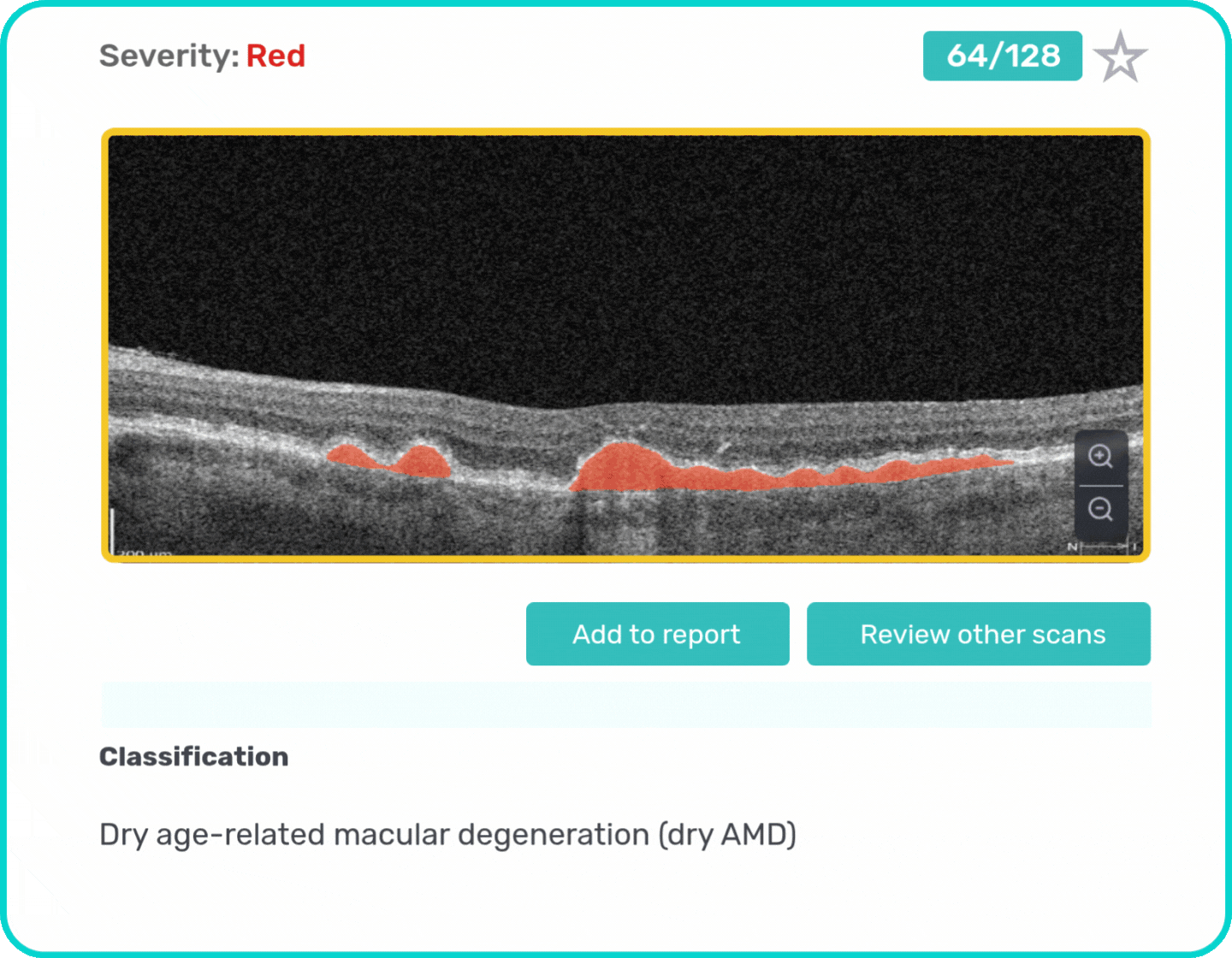 AI Ophthalmology and Optometry | Altris AI