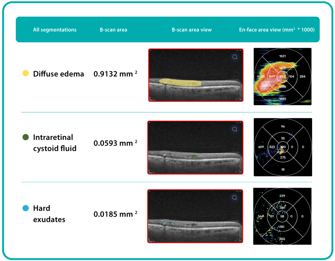 AI Ophthalmology and Optometry | Altris AI