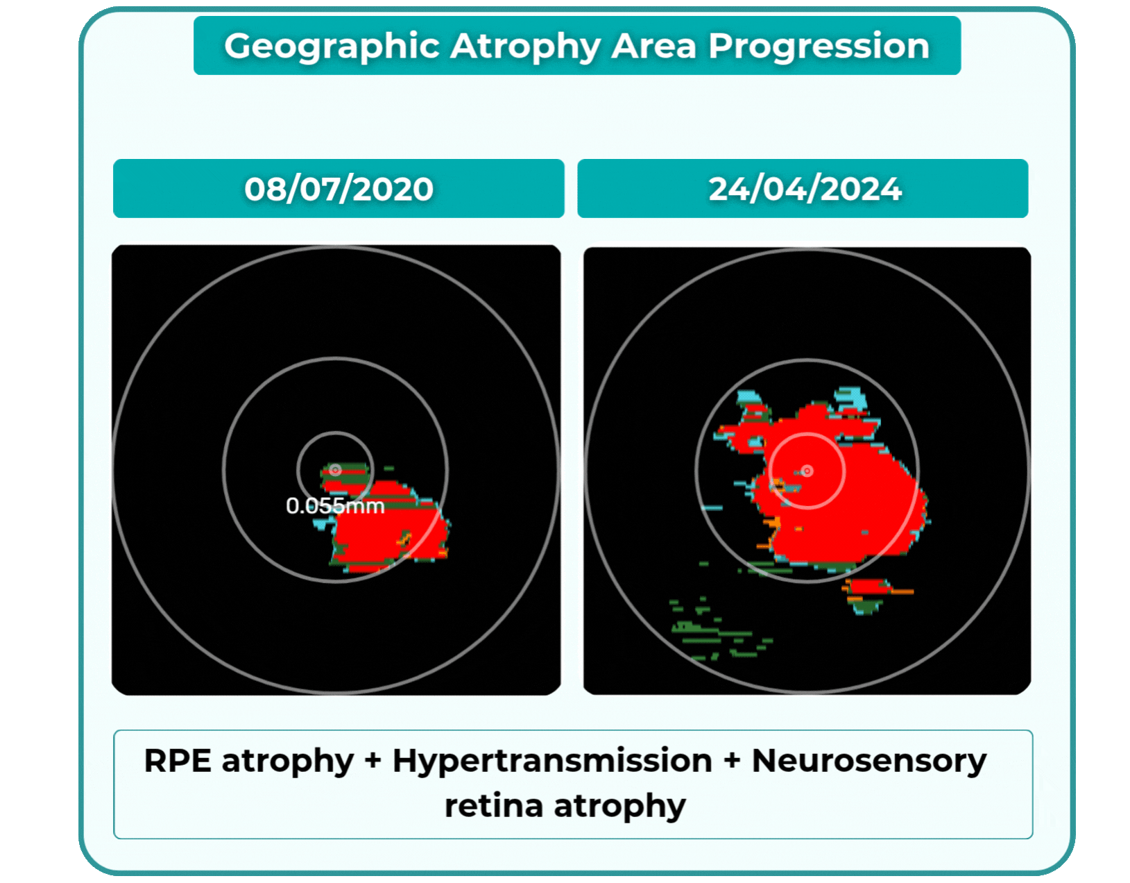 AI Ophthalmology and Optometry | Altris AI