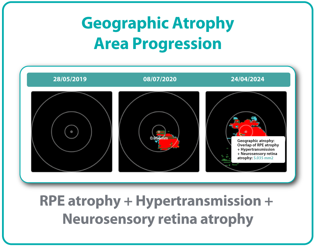 AI Ophthalmology and Optometry | Altris AI