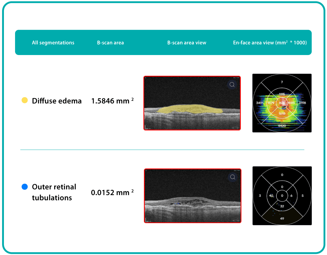 AI Ophthalmology and Optometry | Altris AI