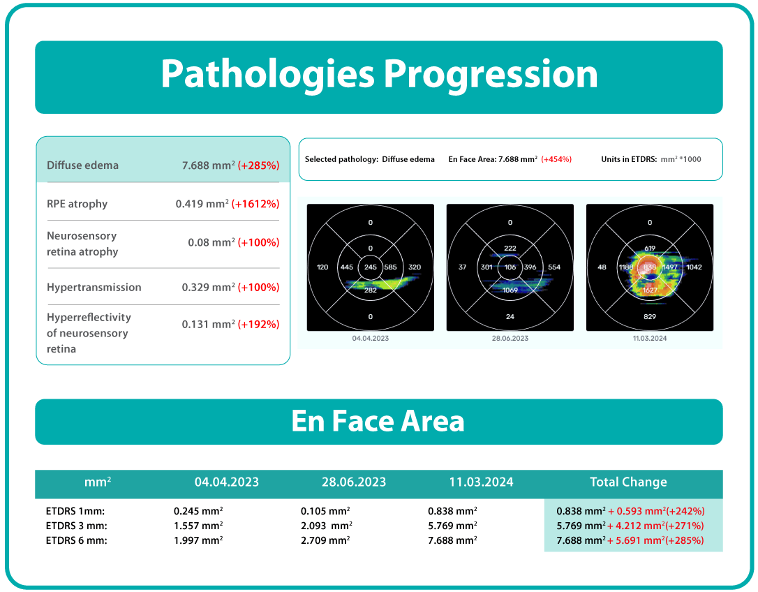AI Ophthalmology and Optometry | Altris AI