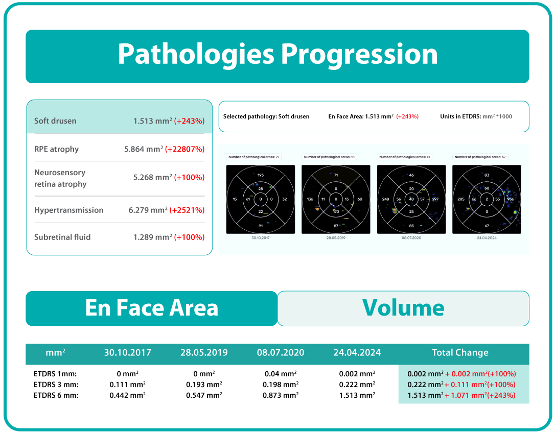 AI Ophthalmology and Optometry | Altris AI