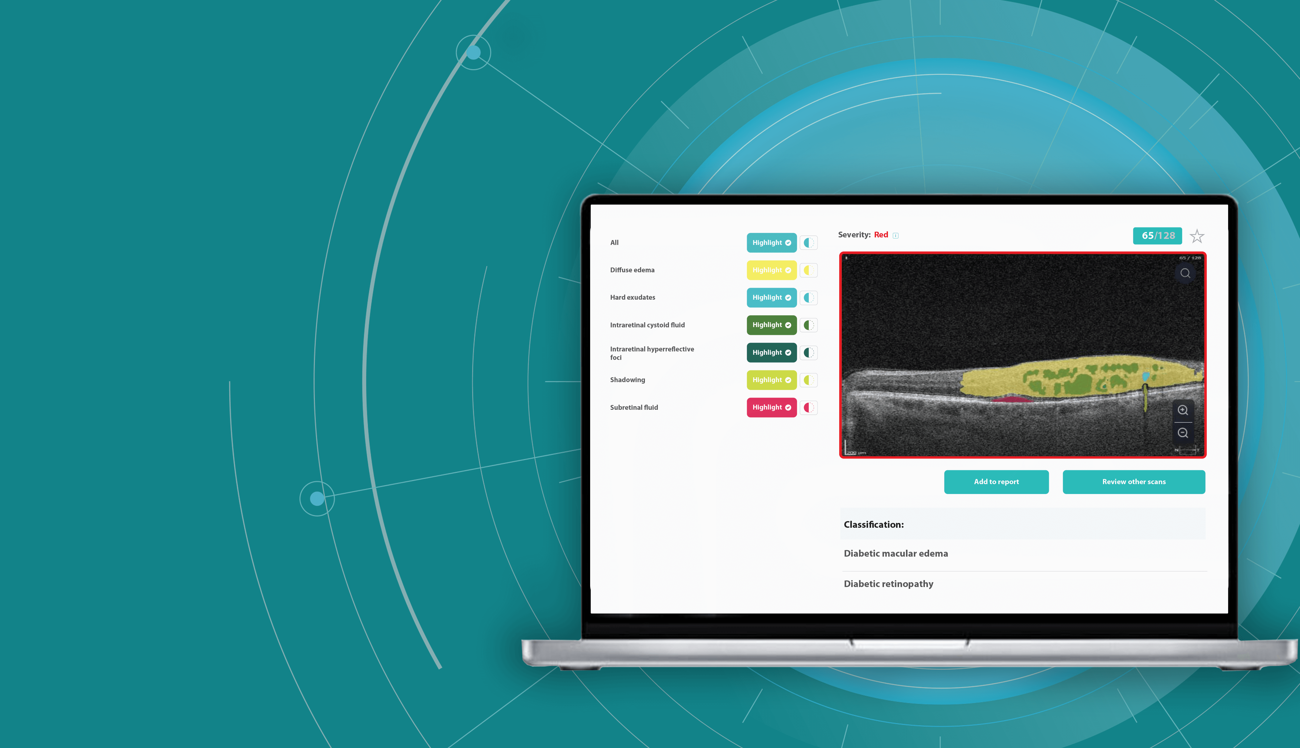 AI Ophthalmology and Optometry | Altris AI