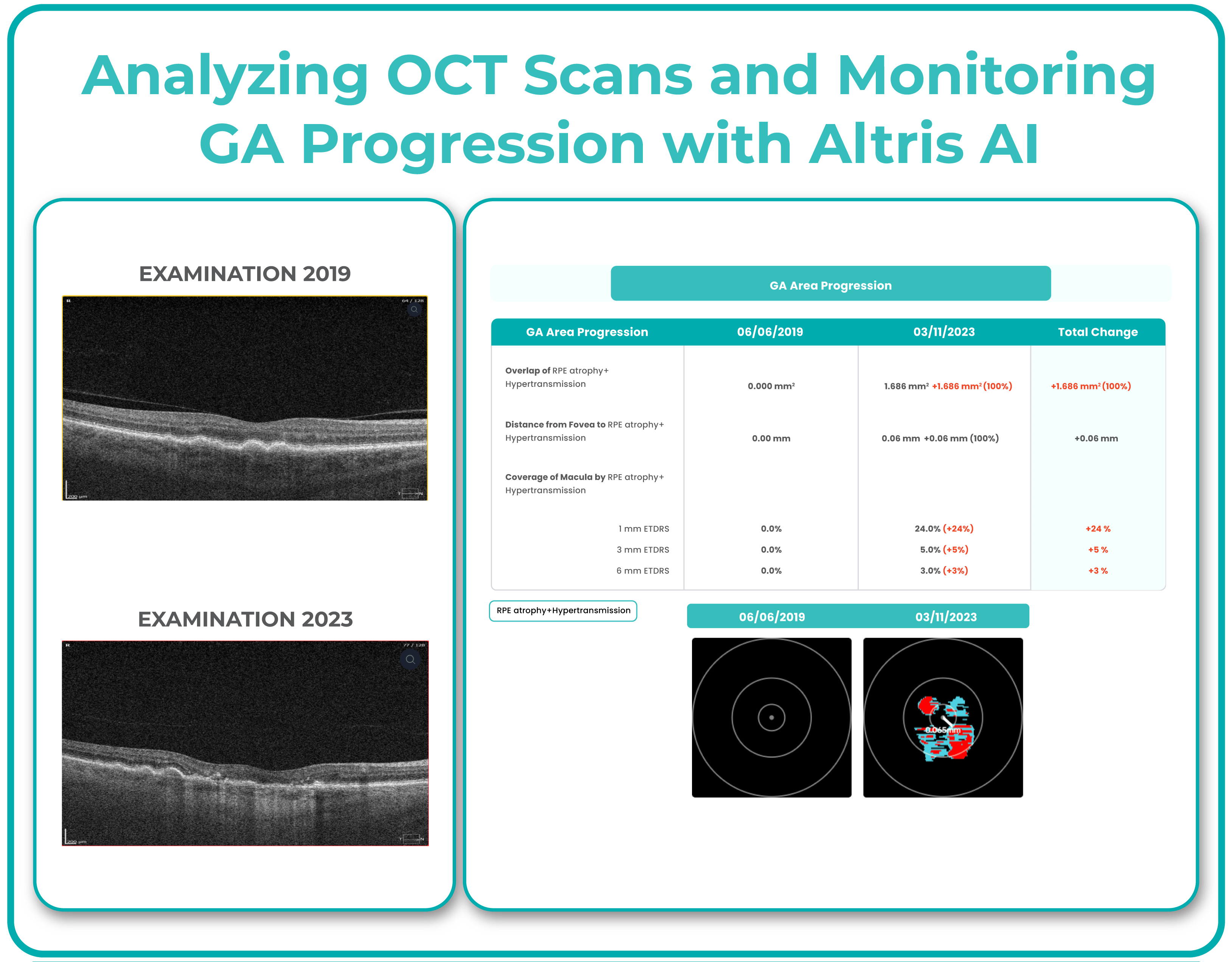 AI Ophthalmology and Optometry | Altris AI
