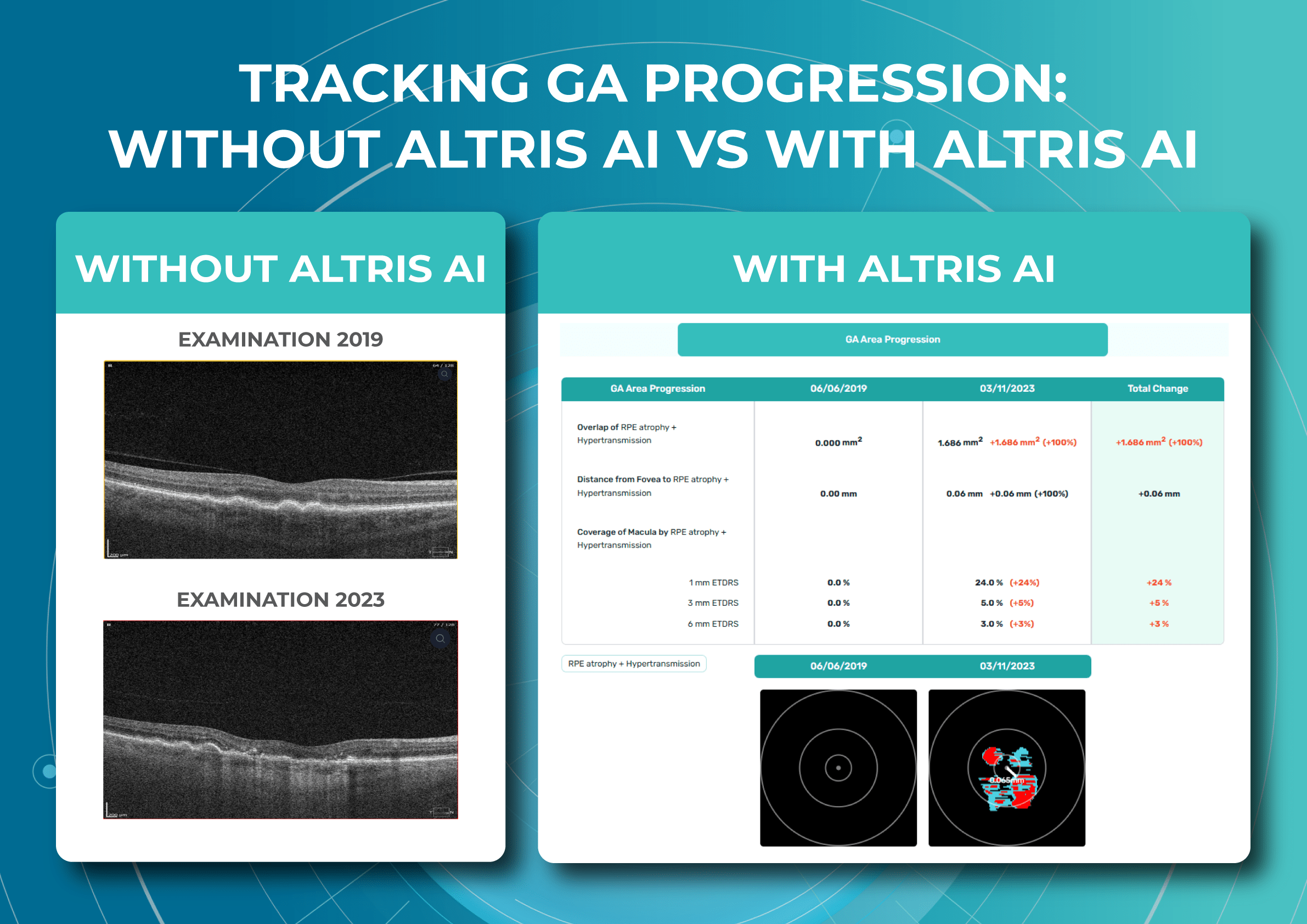 Tracking GA progression