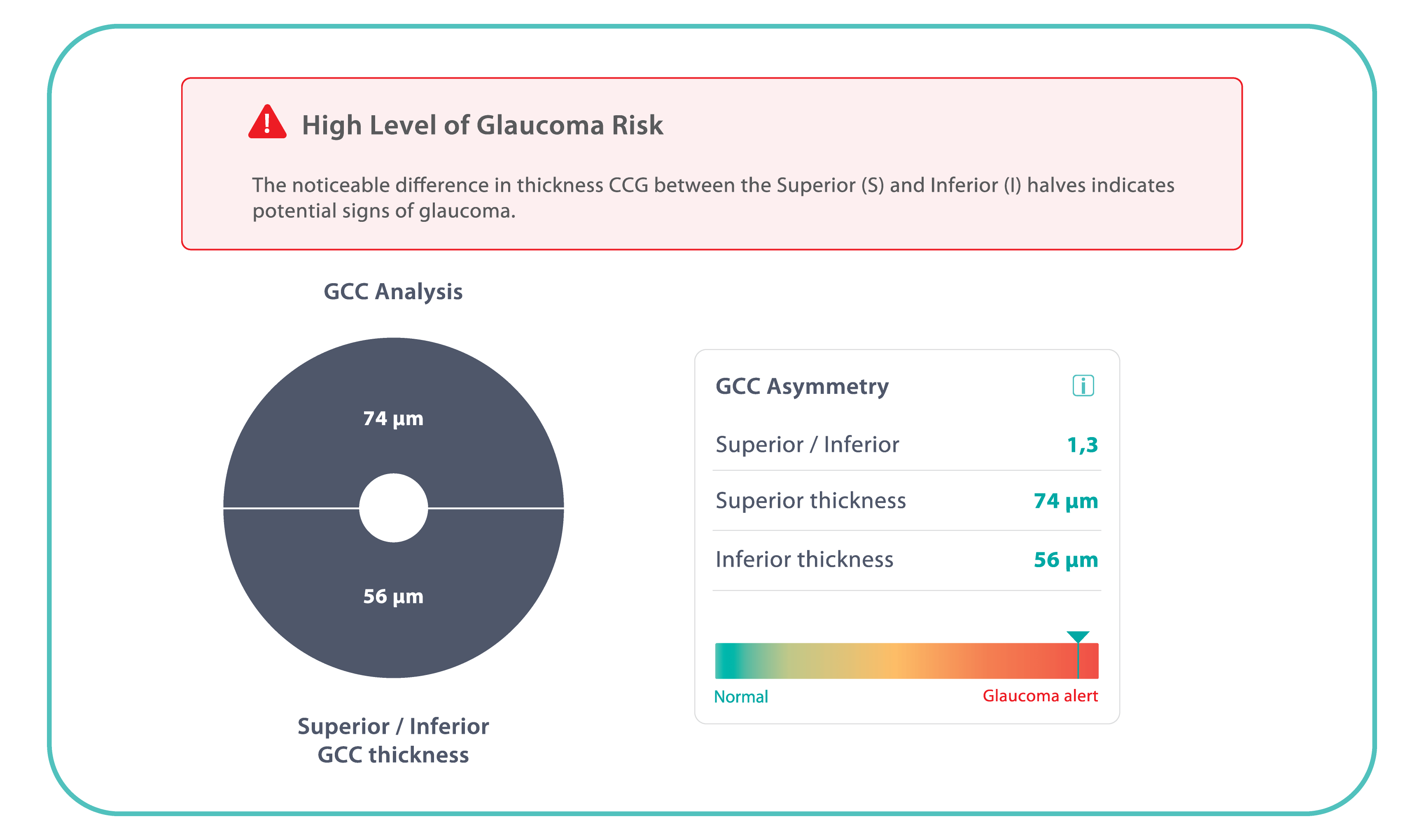 Measuring GCC Thickness and Asymmetry