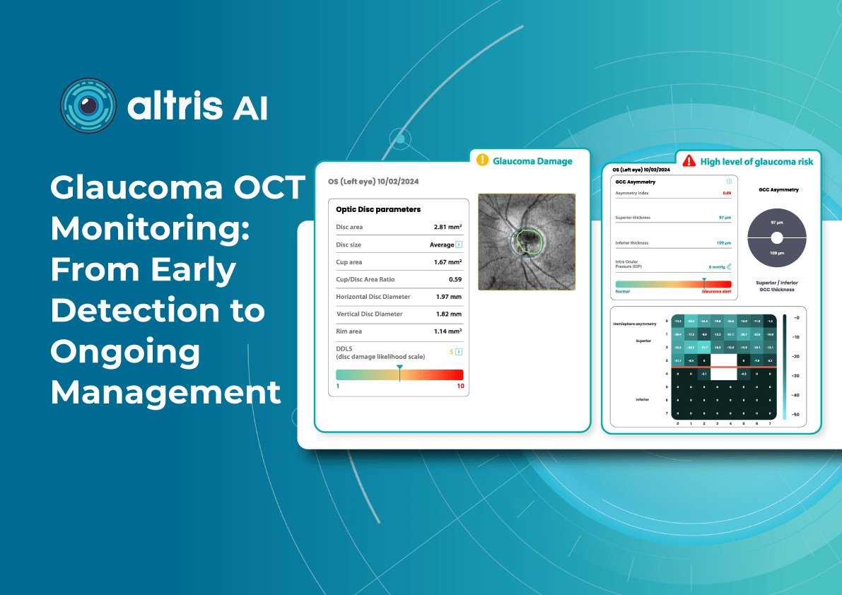 Glaucoma OCT monitoring with Altris AI
