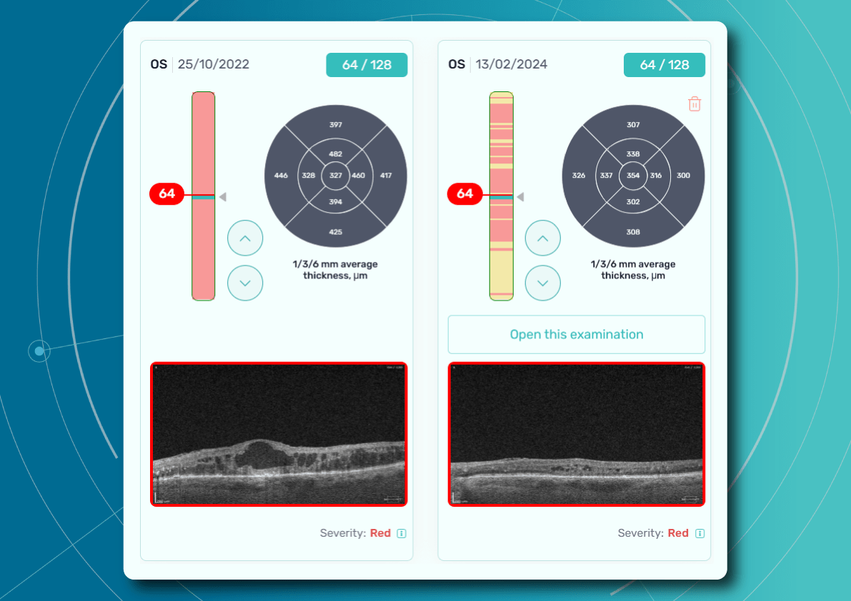 DR Screening with Altris AI