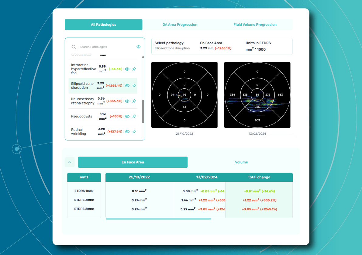 AI in optometry