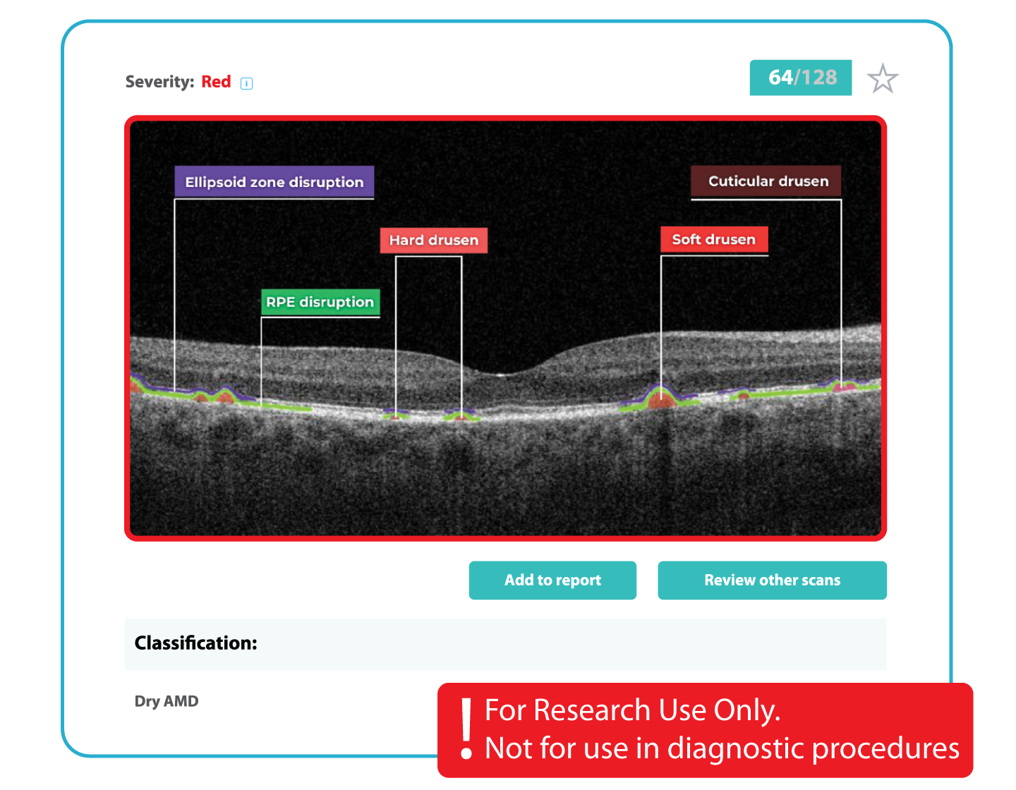 AI Ophthalmology and Optometry | Altris AI