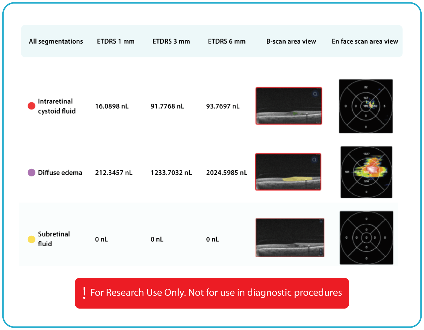 AI Ophthalmology and Optometry | Altris AI