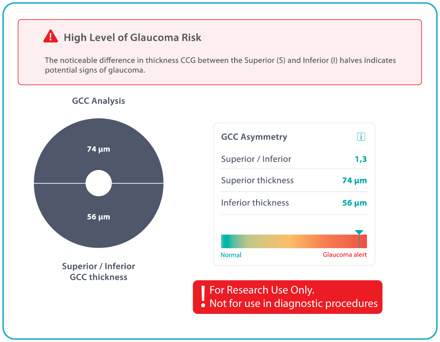 AI Ophthalmology and Optometry | Altris AI