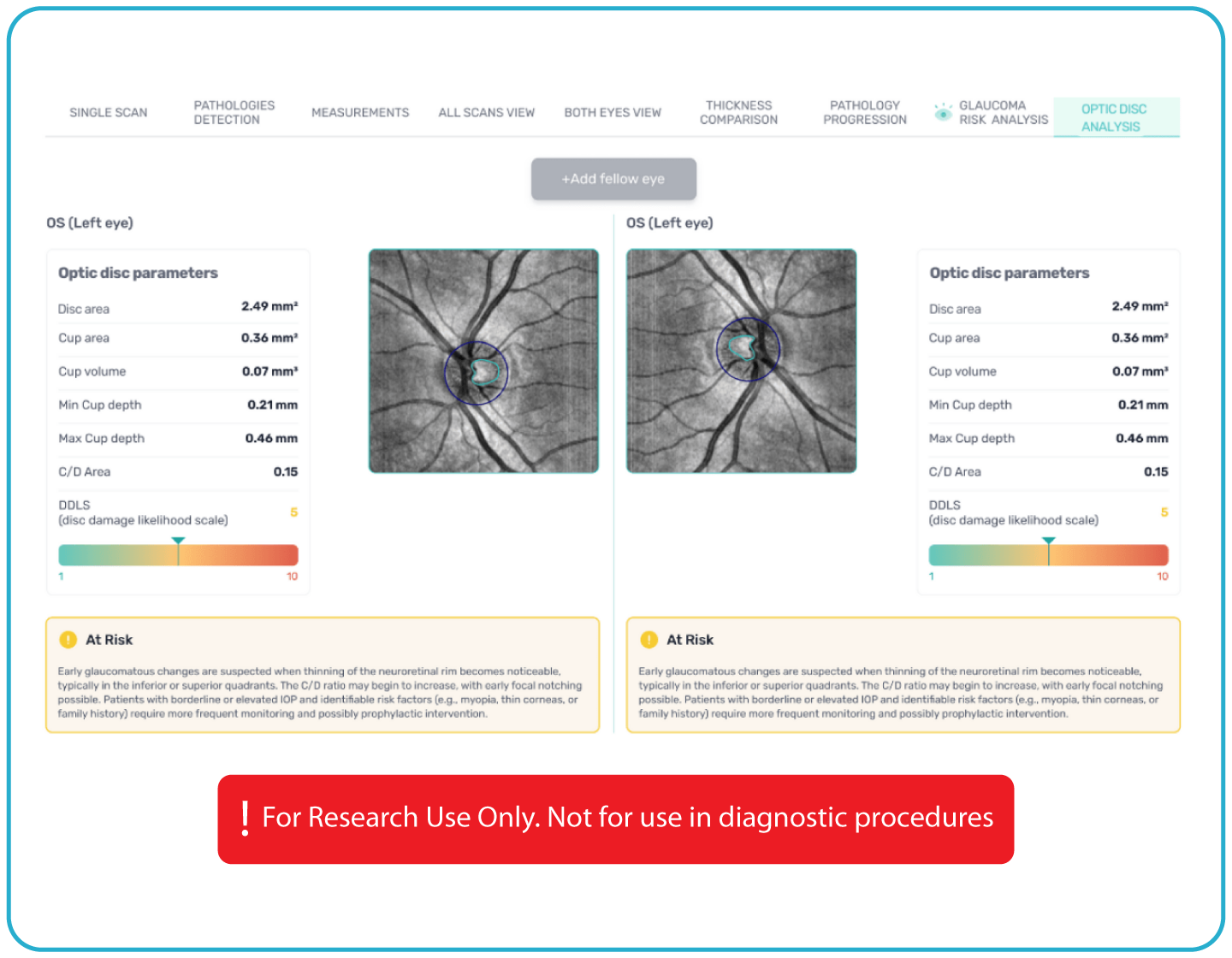 AI Ophthalmology and Optometry | Altris AI