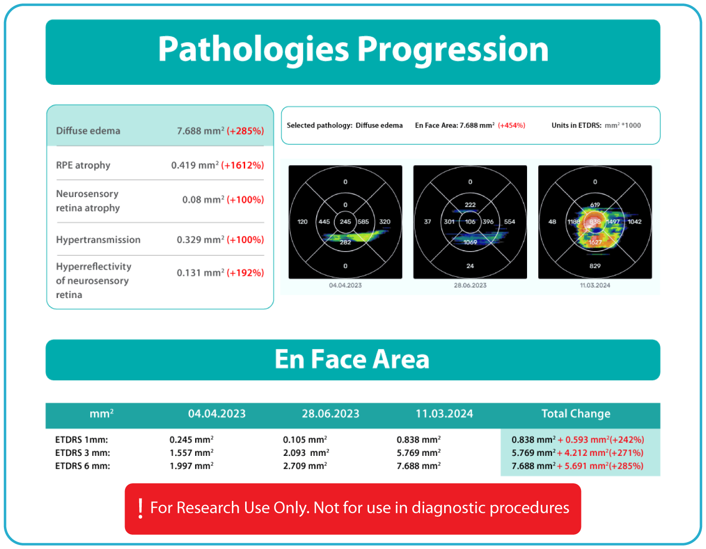 AI Ophthalmology and Optometry | Altris AI