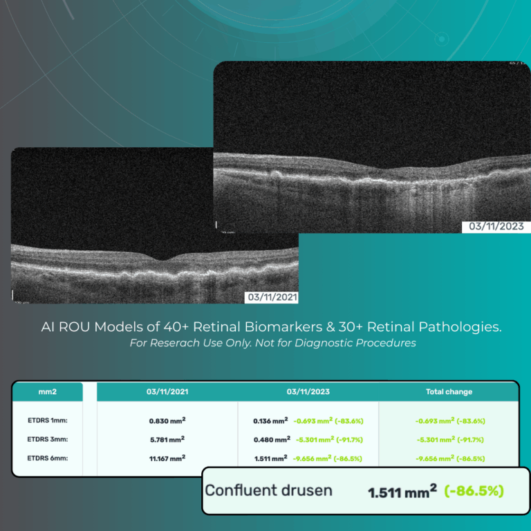 AI Ophthalmology and Optometry| Altris