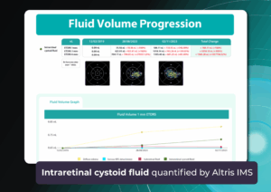 fluid progression