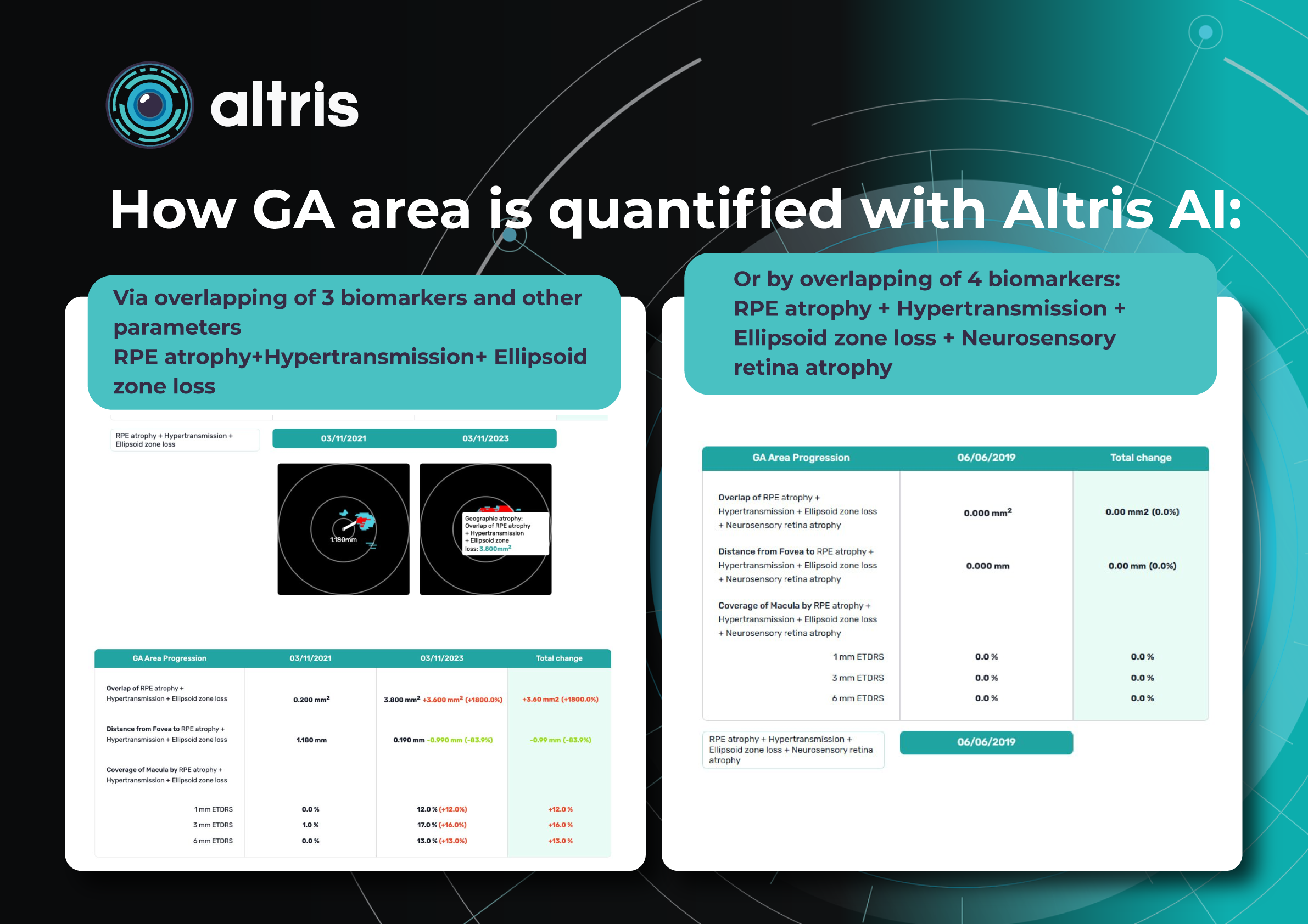 ga area quantification