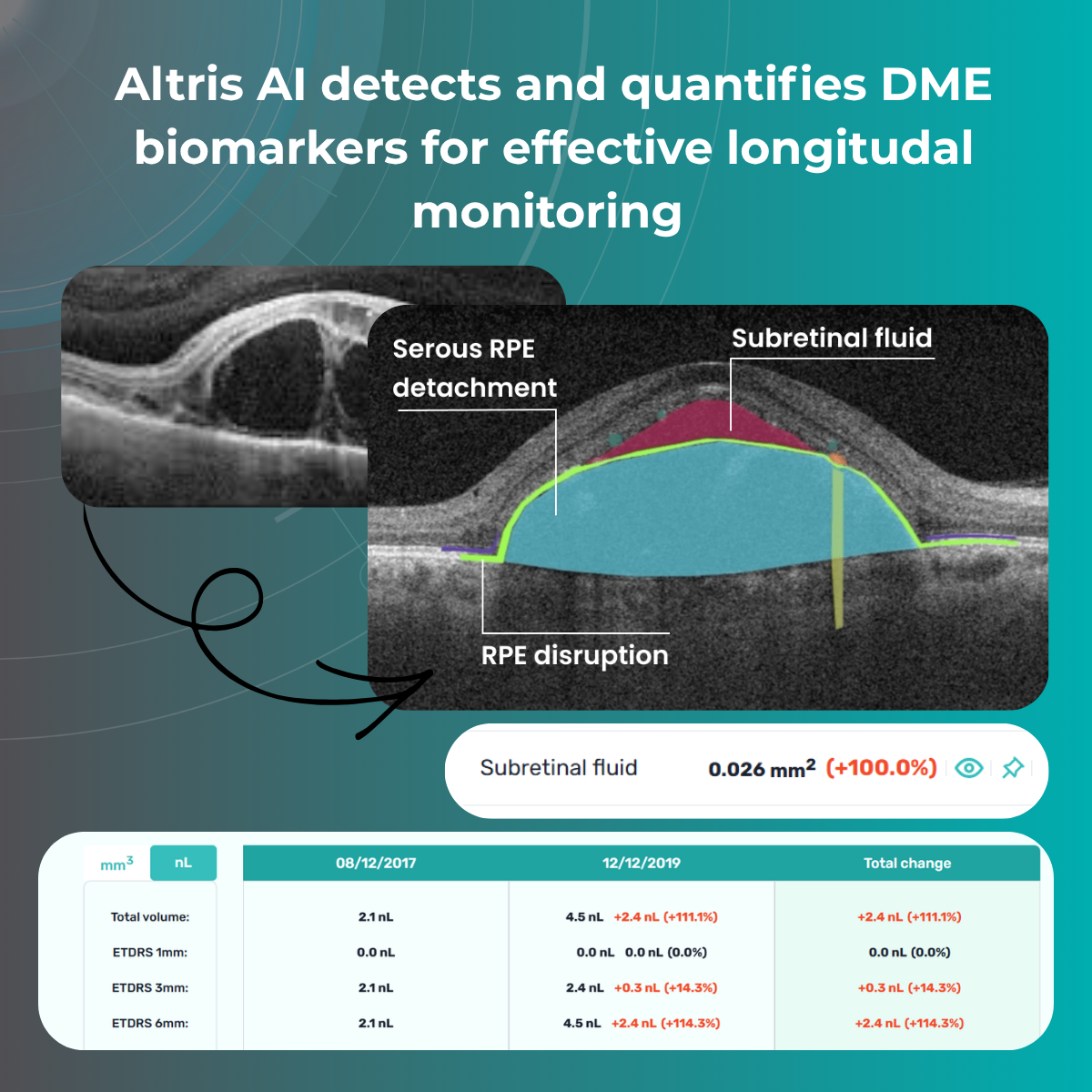 detect dme
