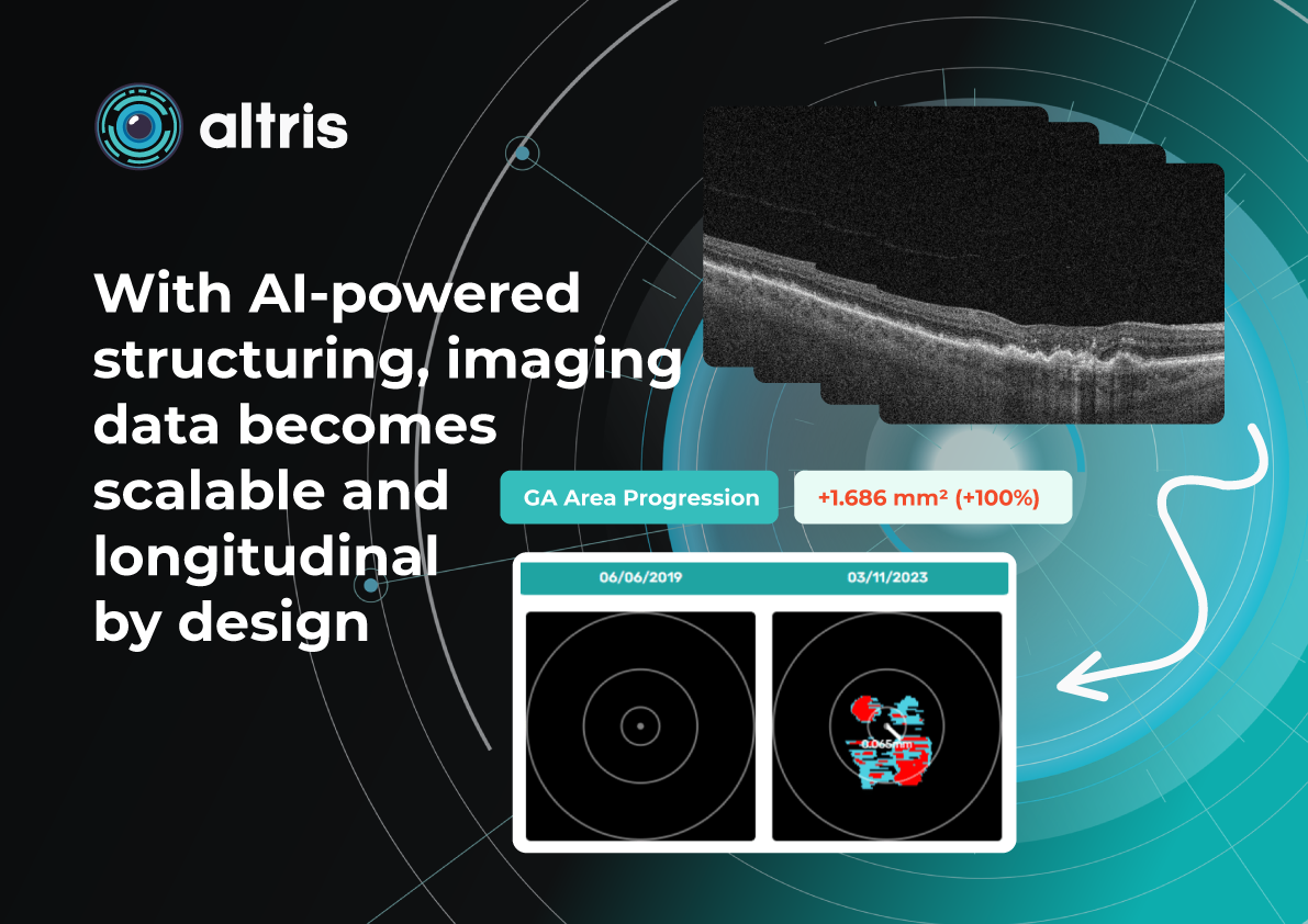 GA AI